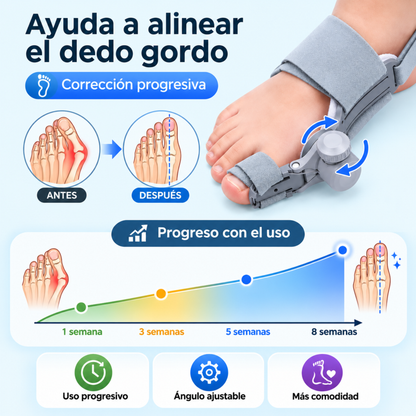 Corrector de JUANETES